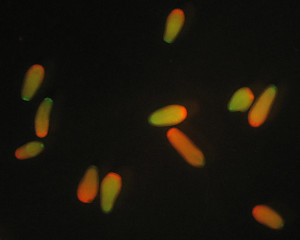 A.millepora_fluorescent_larvae - Mikhail