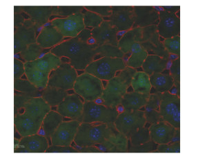 Liver section from a mouse treated with recombinant adeno-associated viral vectors (rAAV) to force the main liver cell type (hepatocytes) to express Green Fluorescent Protein (GFP). These vectors are the same as those used in gene therapy to correct a gene defect in humans. In this study, these vectors were however used as tools to express both GFP and a model antigen and investigate how immune cells recognise this antigen. The actin (a protein mostly localised under the cell membrane that allows the cell to maintain its shape) is in red while the blue stain reveals the cell nuclei.