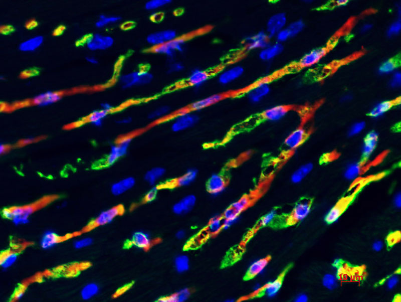Cardiac progenitor cells in adult human hearts (photo by Corey Heffernen)