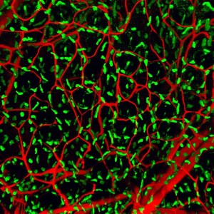 Mast cells are sentinel immune cells that can be found in all organs of the body and protect us agains worms and other parasites but are also involved in asthma and allergy. Shown here is a 3D representation of mast cells (green) distributed evenly throughout the skin, with blood vessels shown in red. 