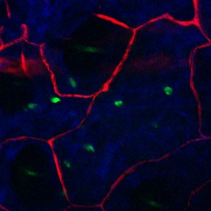 False colour image of the skin showing the newly discovered cells. Red = blood vessels, Blue = collagen, black holes = hair follicles (with green hairs). Newly discovered cells in green.