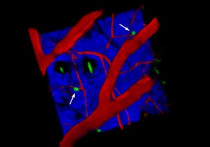 False colour image of the skin showing the newly discovered cells. Red = blood vessels, Blue = collagen, black holes = hair follicles (with green hairs). Newly discovered cells in green.