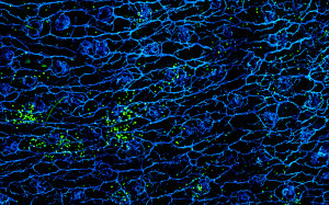 Immune ‘atlas” shows distribution of T cells, (in green) surrounding blood vessels (blue) in the skin.