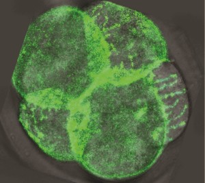 For the first time, we have been able to watch as filopodia reach out and grab neighbouring cells, pulling them closer and elongating the cell membranes. Credit EMBL Aus